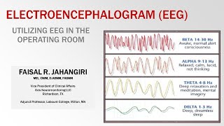 EEG  Utilizing EEG in the operating room