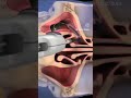 Balloon sinuplasty