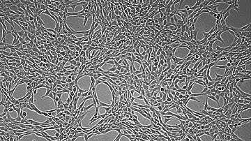 NIH 3T3 cells growth by using JuLI Br 65 hrs