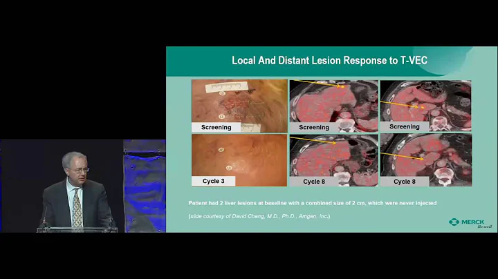 2016 SID Naomi M  Kanof Lecture, Roger Perlmutter,...