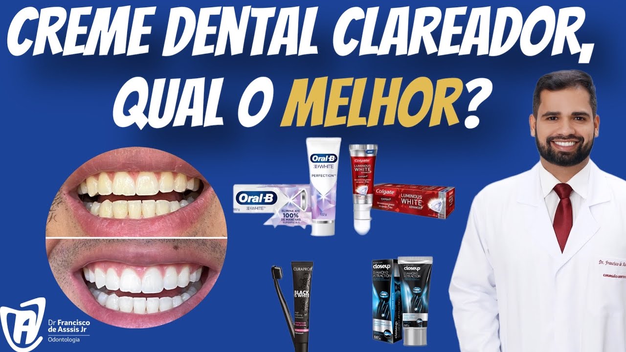 Creme dental para CLAREAMENTO, qual o melhor? Para qual ocasião?  #clareamentodental #cremedental - YouTube