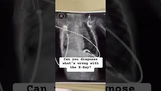 This one’s Easy X-Ray Pathology! #cardiology