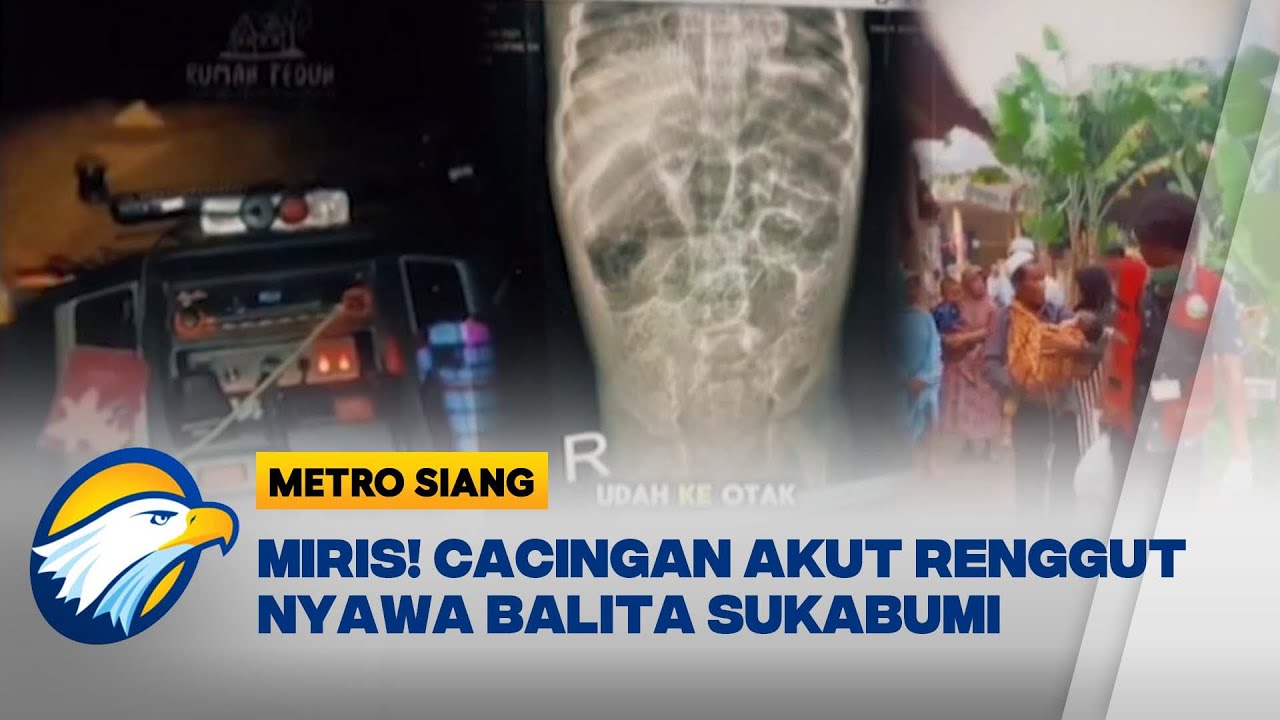 Tragis! Raya Balita Sukabumi Meninggal Penuh Cacing Parasit - [Metro Siang]