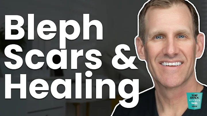 Do Upper Eyelid Blepharoplasty Scars Show? Tips to Minimize Incision Visibility