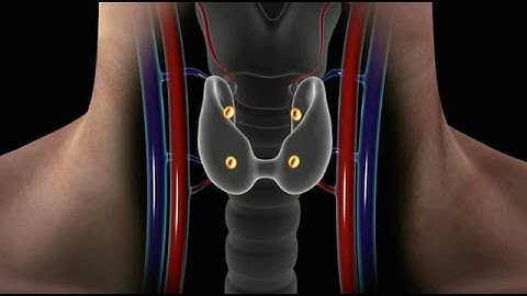 Overview of Parathyroid Disease (Causes, Symptoms and Treatment for Hyperparathyroidism)