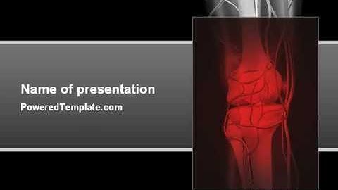 Joint PowerPoint Template by PoweredTemplate.com