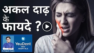 जानते हो अकल दाढ़ किस काम आती है ? Dental Care | V 04 | YouDent India Hospitals