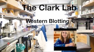 Western Blot Tutorial│University of California, Los Angeles (UCLA)