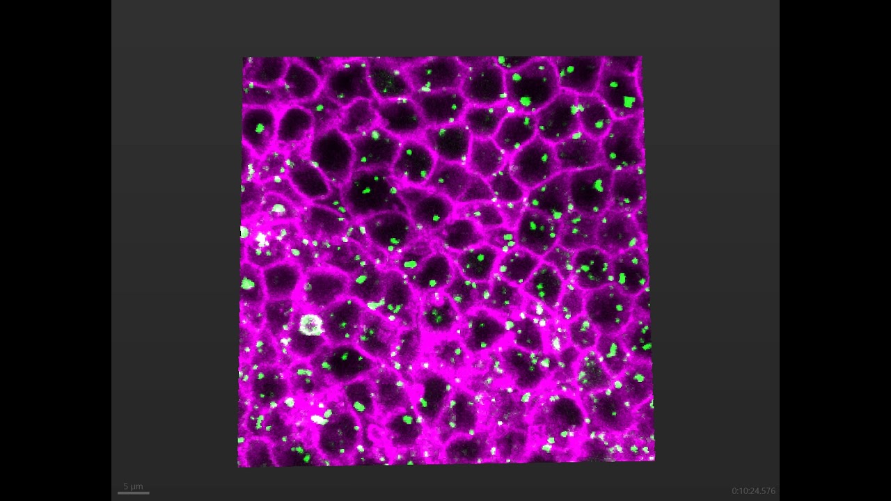 Live imaging (Drosophila pupal wing): CAAX:mCherry and FYVE:GFP