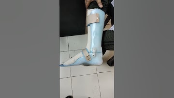dorsi flexion assist AFO