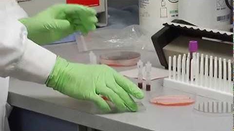 3 Red Cell Count:  Loading Hemocytometer