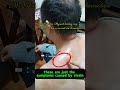 Real Doctor Physical Therapy Case Study: Mr. You's Cervical Disc Herniation — First Treatment