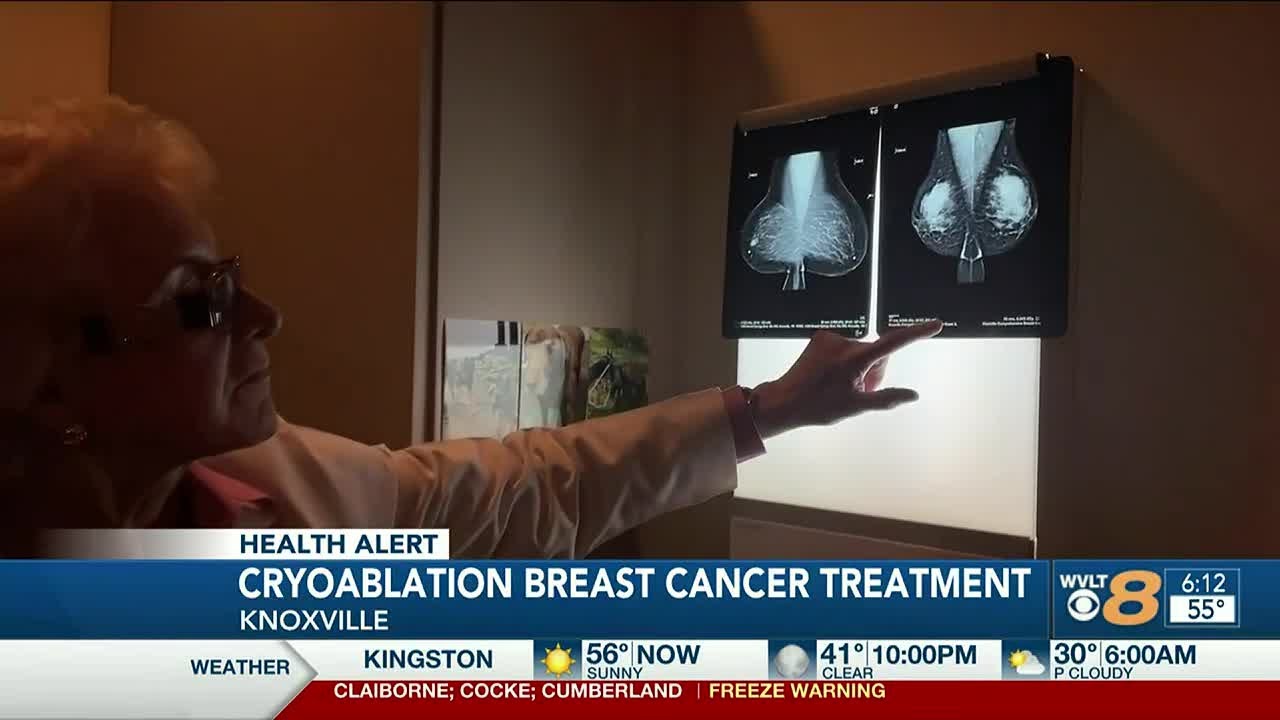 Knoxville Breast Cancer Facility Offering Minimally Invasive Treatment Knoxville Breast Cancer Facility Offering Minimally Invasive Treatment