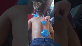 Cupping or Vendosa Massage 50 15 minutes Bartlett Itasca Bolingbrook Aurora Little Rock Leland