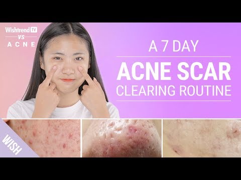 Acne Scars: How to Prevent & Quickly Remove Various Types | Wishtrend TV VS ACNE