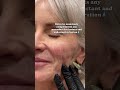 Unlock Radiant Skin with Skinvive