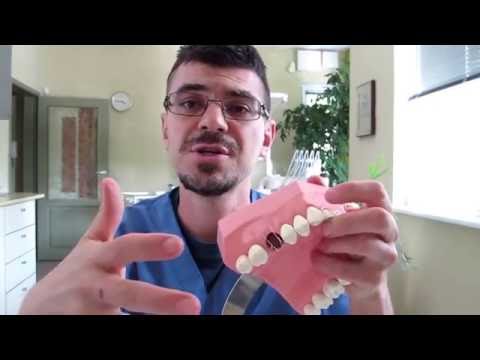 Видео: 7 съвета за премахване на лепило за протези от венците - wikiHow