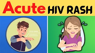 Acute HIV Rash: Symptoms, Causes, and Treatment Options screenshot 4