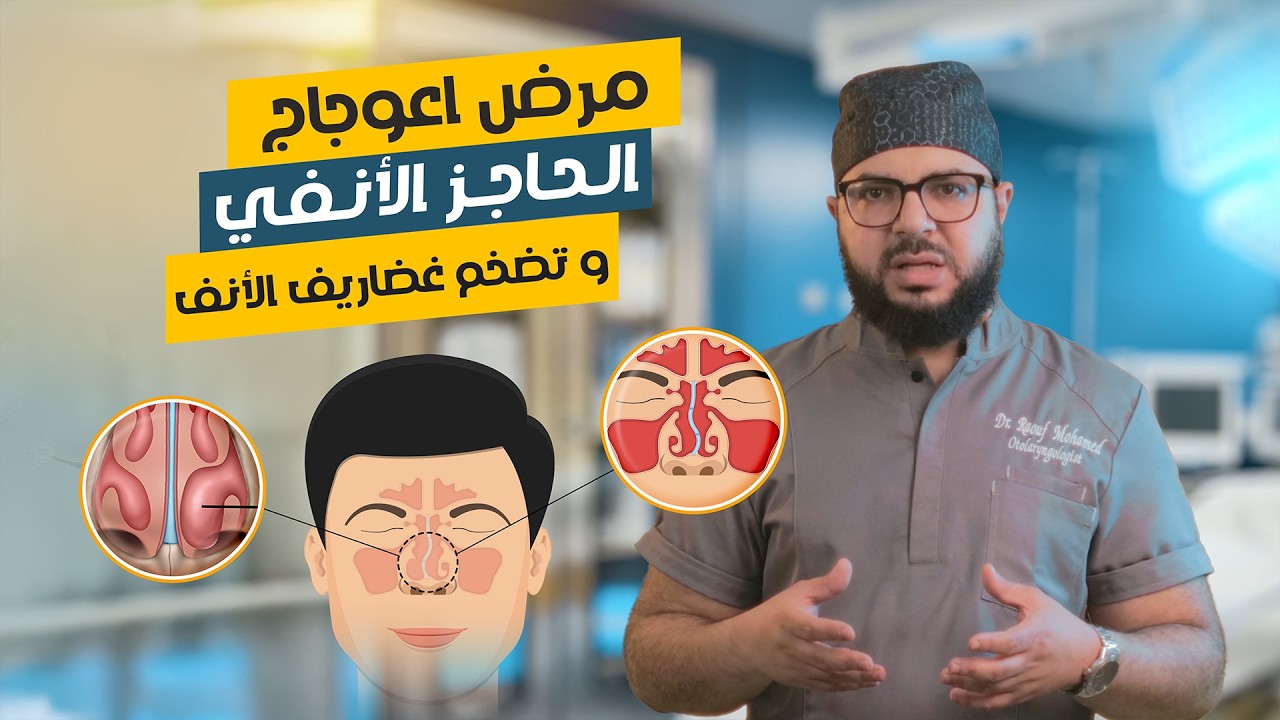 اعوجاج الحاجز الأنفي وتضخم غضاريف الأنف | الأعراض والعلاج وهل العملية ضرورية؟