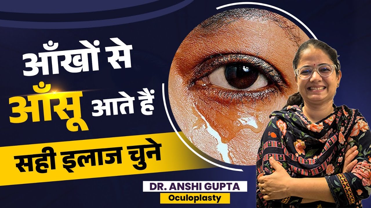 Watery eyes I  Watery eyes treatment in hindi I Excessive tearing in eye 
