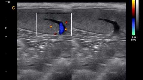Shinova Veterinary - Portable Veterinary Color Doppler Scanning (DopScan N9V)
