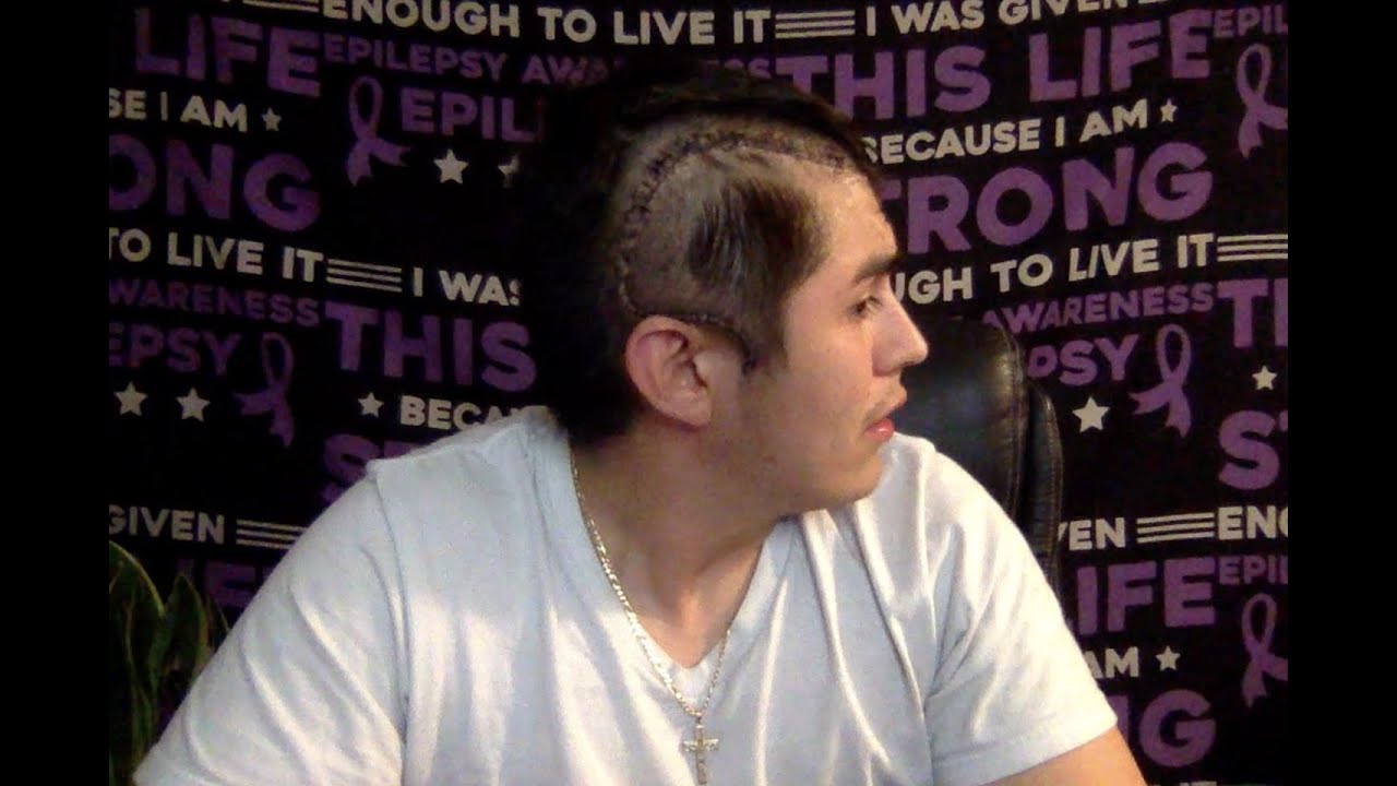 Back Home after Brain Surgery for Epilepsy YouTube