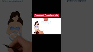 Do you know what preeclampsia is???🤔🤔 Check my page to learn more on it#pregnancytips #preeclampsia
