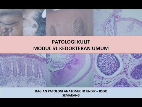 Praktikum Patologi Anatomi Sistema Dermatologi (Patologi Kulit)