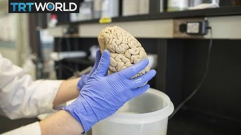 Neuroscientist crowdfunds to expand 