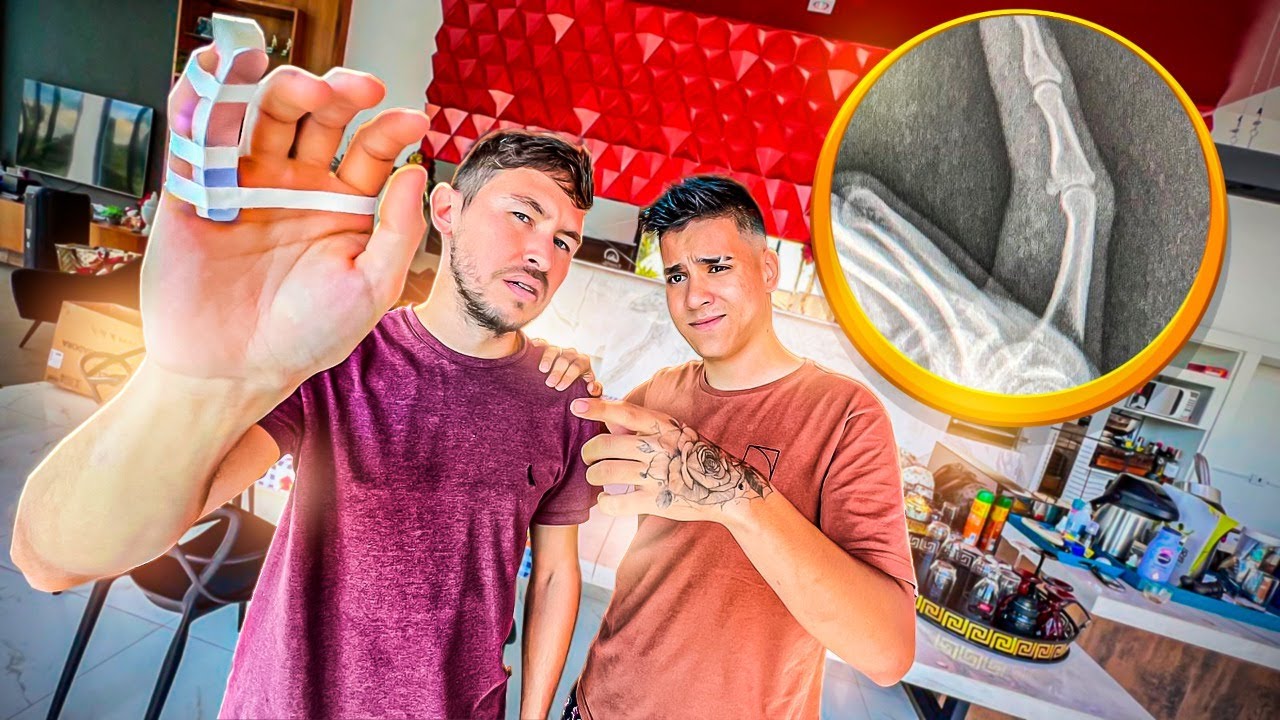 QUEBREI O DEDO MEU AMIGO RENAN - TÔ MUITO TRISTE 😞
