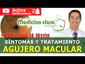 ¿Ves líneas curvas en lugar de rectas? 😳 Puedes tener un agujero macular (retina) | Medicina Clara