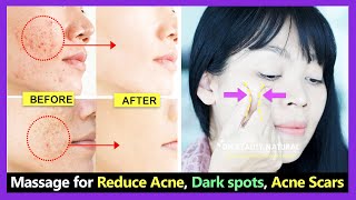 How to get rid of acne, reduce open pores, remove acne scars and dark spots with Face massage screenshot 5