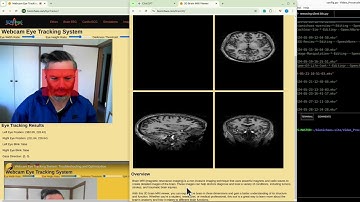 Interactive Brain3D: Volumetric Brain Imaging, Loading Optimization & 3D Rendering Improvements