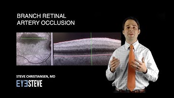 Branch Retinal Artery Occlusion