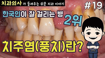 [치과의사의] 치은염부터 치주염(풍치)까지 (치주질환, 잇몸질환)