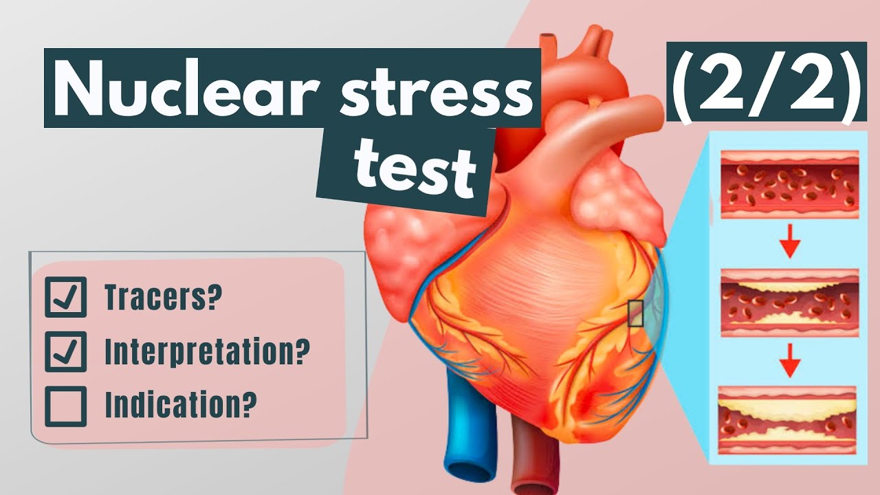 ⁣Nuclear stress test: Tracers, interpretation and indications (2/2)