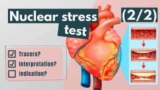 Nuclear stress test: Tracers, interpretation and indications (2/2)