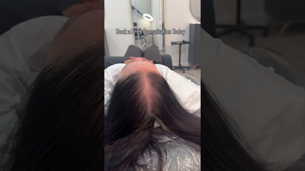 ✨ From thinning to thriving—watch her confidence shine! 