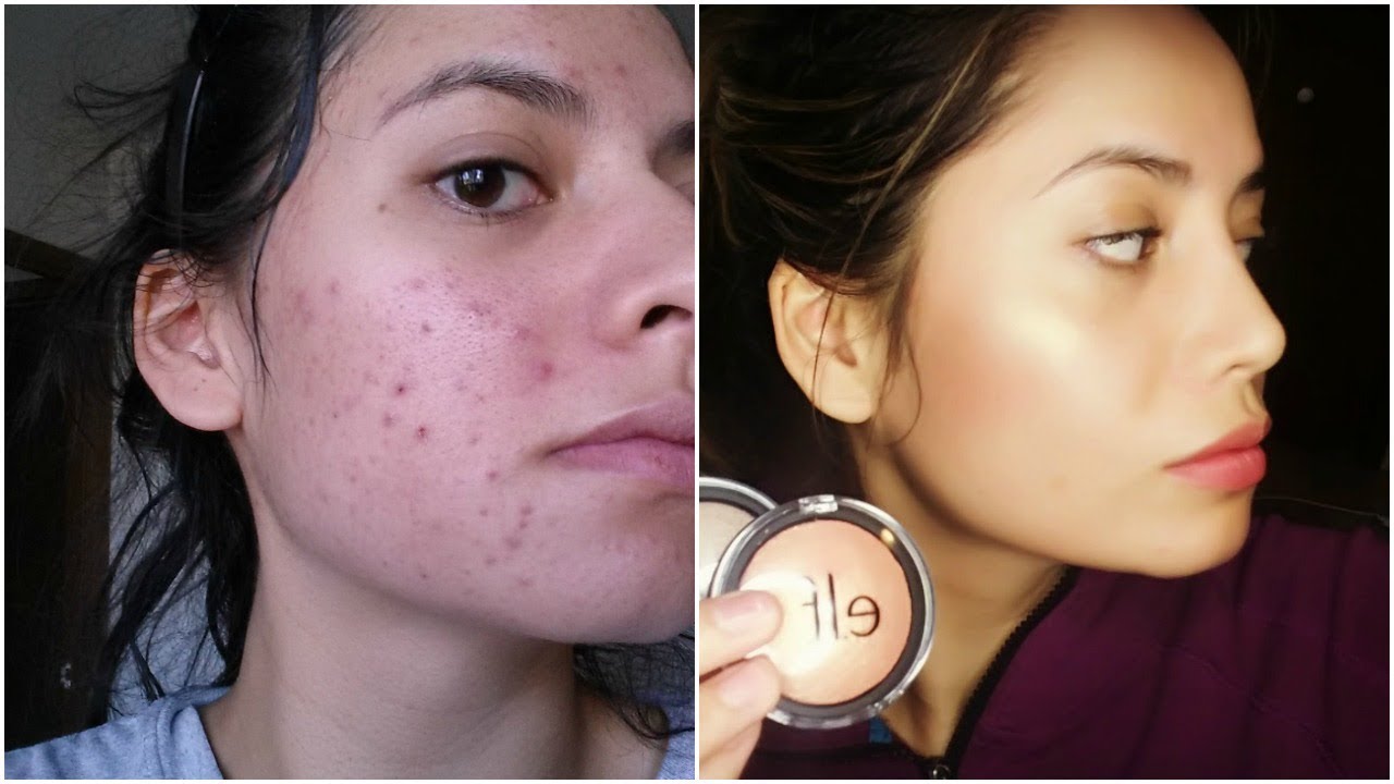 HOW TO DEAL WITH THE RETINA "UGLY PHASE" HOLY GRAIL TIPS! YouTube