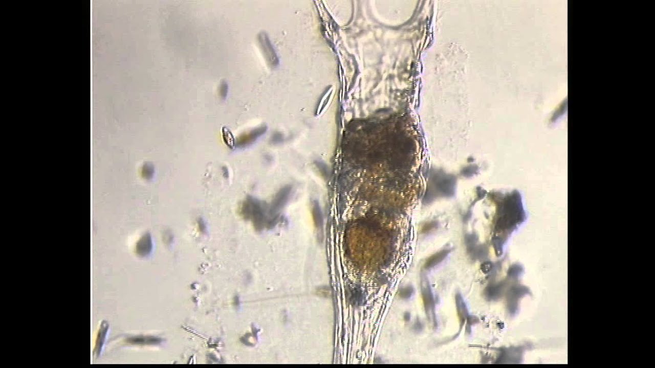 COLLOTHECA TENUILOBATA ROTIFERO ROTIFER microorganismo causador do sarampo