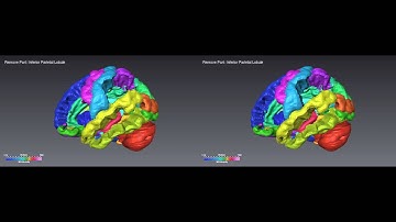 Surface Rendering Brain Selection 3D