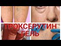 Троксерутин гель. Аптечная мазь от варикоза, отеков, мешков под глазами и целлюлита.