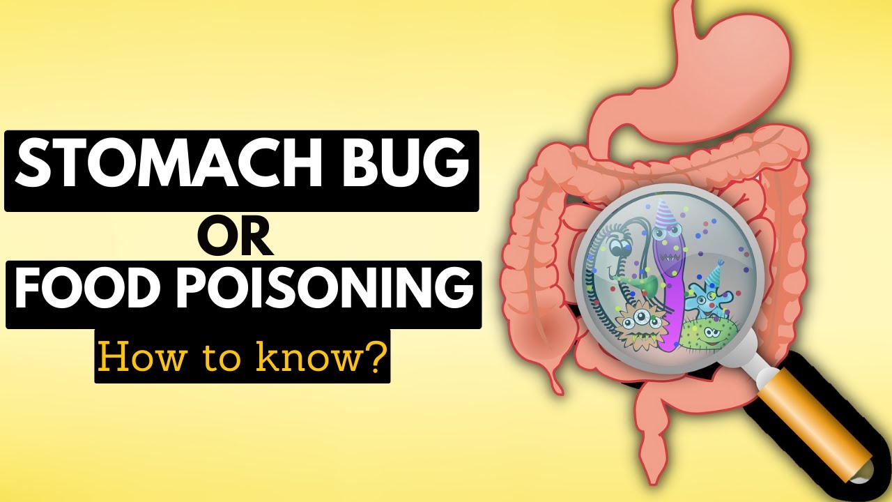 How to Tell if You Have a Stomach Bug or Food Poisoning A Complete