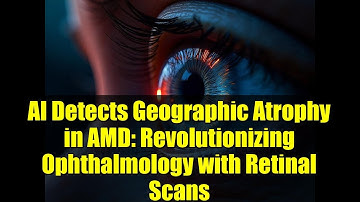 AI Detects Geographic Atrophy in AMD: Revolutionizing Ophthalmology with Retinal Scans