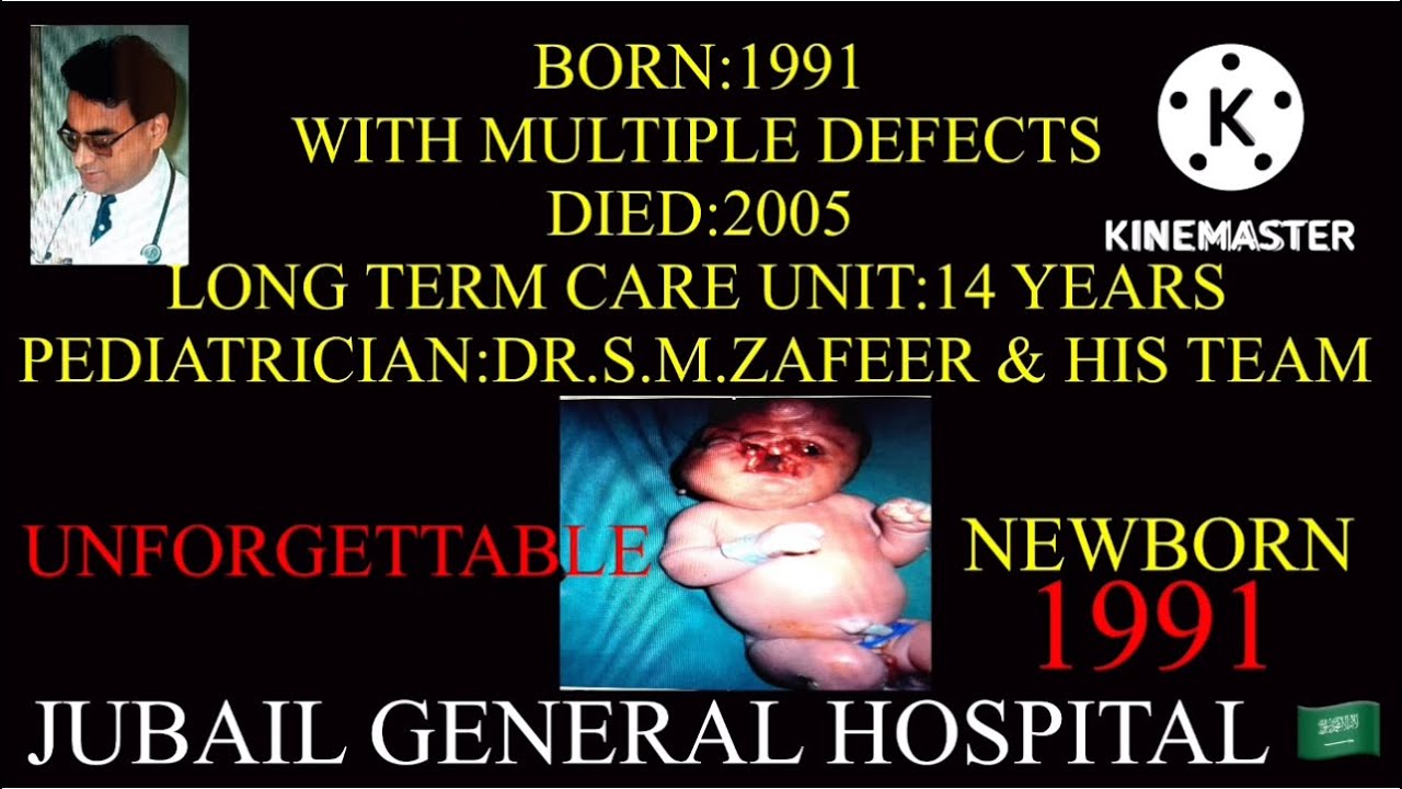 MULTIPLE BIRTH DEFECTS. DR.S.M.ZAFEER PEDIATRICIAN Toronto 🇨🇦 YouTube