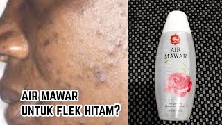 CARA MUDAH MENGHILANGKAN FLEK HITAM MENGGUNAKAN AIR MAWAR VIVA