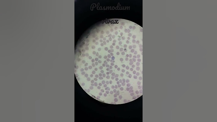 Malaria parasite under microscope 🔬| trophozoite of plasmodium vivax||#malaria #dmlt #shorts