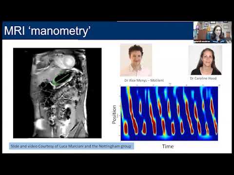 Better Together: Bridging the Divide Between Pediatrics & Adult GI Motility Disorders: Gastroparesis