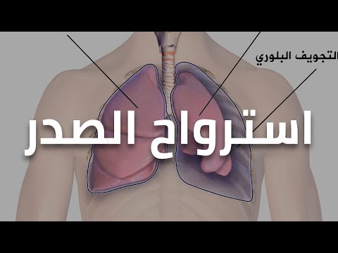 فيديو: كم من الوقت يستغرق حل استرواح الصفاق؟