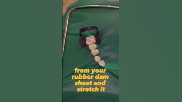 Top Rubber Dam Tips #2
